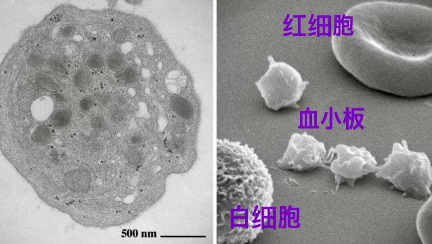 汪先恩：探索血小板疾病治疗的深度思考