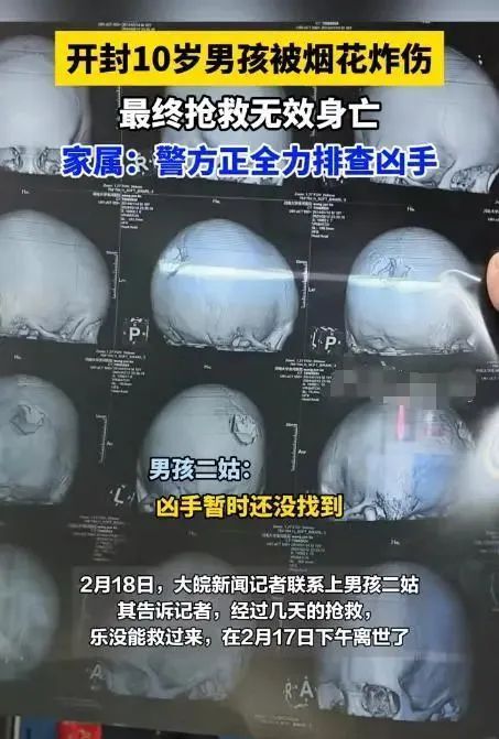 痛心！烟花扎进10岁男孩后脑勺爆炸，家属：孩子没救过来，凶手尚未找到