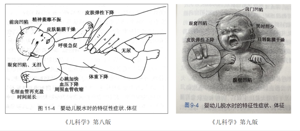 【儿医留言板】 让孩子“上吐下泻”的病毒到底是什么？