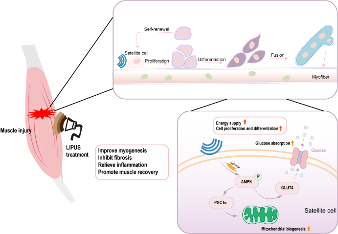 谢黎炜团队发现低强度脉冲超声在促进骨骼肌再生方面的新应用