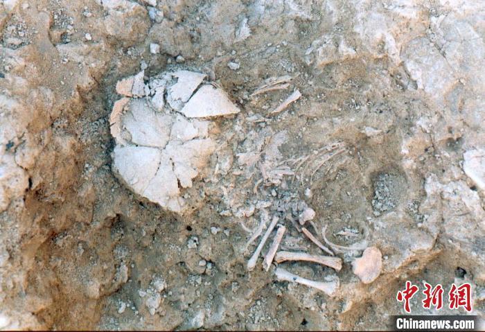 国际最新研究发现5500年前古人类患有染色体病病例