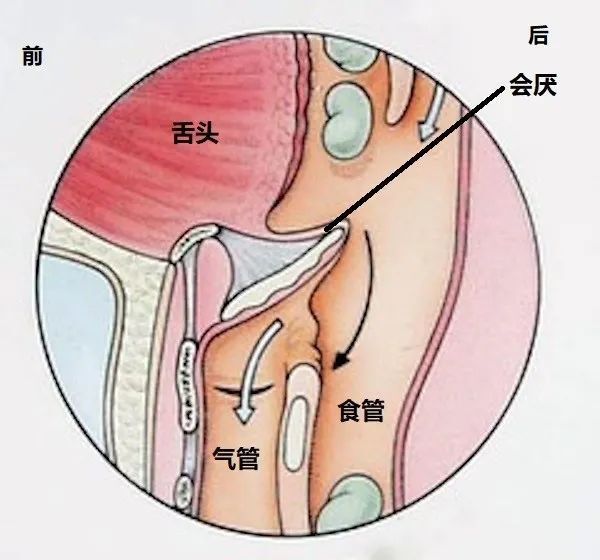 一旦出现这个姿势，无论孩子还是成人，都要立即就医