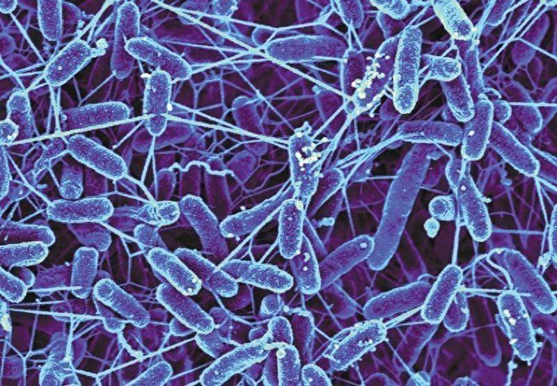 我们能在太空生存吗？这取决于我们的肠道微生物群如何适应