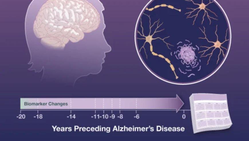 贾建平团队 NEJM 论文揭示：提早18年，找到阿尔茨海默病异常生物标志物。