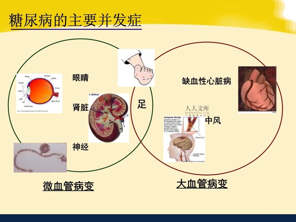 糖尿病都必须吃药打针吗？2种情况可以不需要