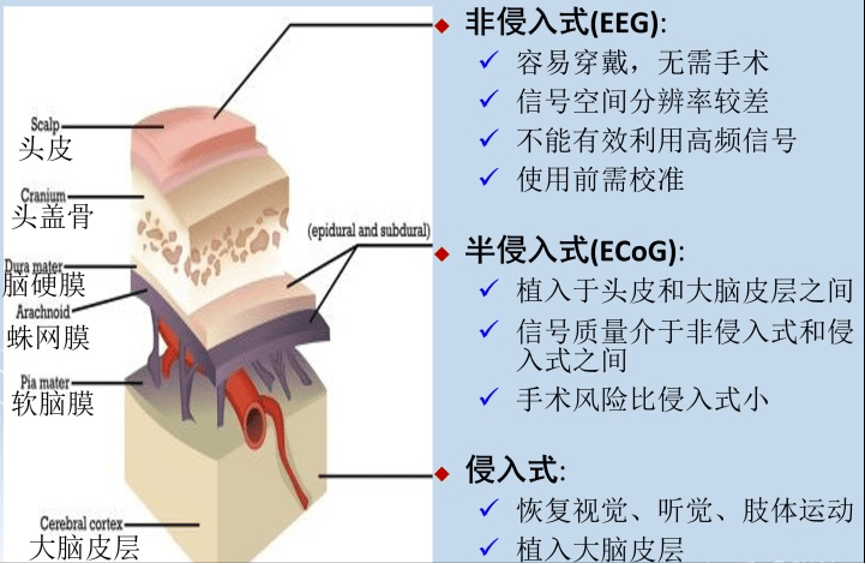 让盲人重现光明？聊聊Neuralink和视网膜脑机接口