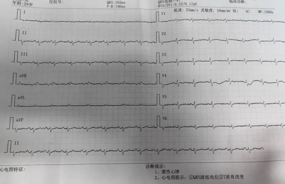 患者的心脏竟消失了！别慌，心电图带你抽丝剥茧找真凶