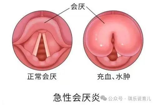 今天和大家分享一个小宝宝生病的故事