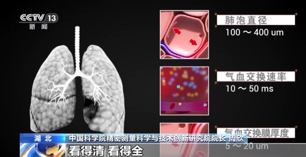 只需3.5秒 肺部磁共振技术取得新突破