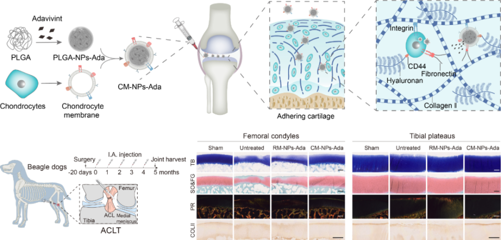 Science子刊：余家阔/聂广军团队开发仿生纳米药物，用于骨关节炎治疗