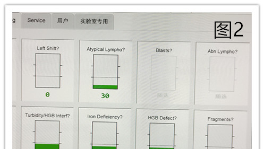 20天内，幼儿血小板急降100倍？一起揭示巨细胞病毒引发的婴幼儿紫癜症。