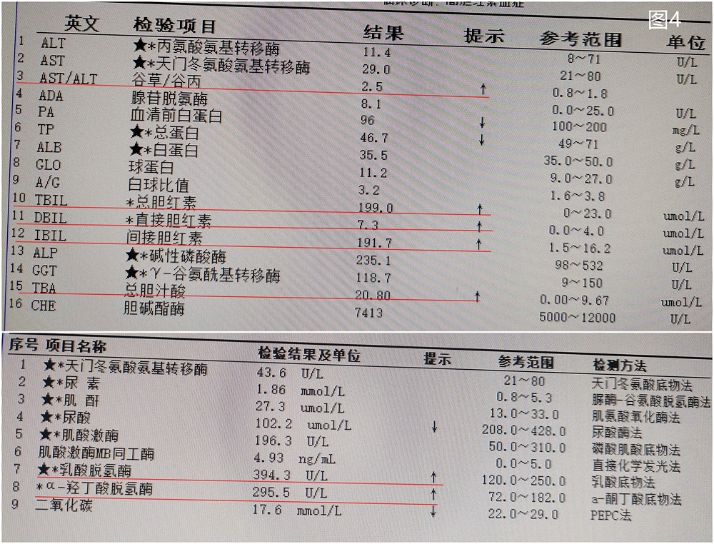 短短20天，这名幼儿的血小板数值减少了100倍？——记一例巨细胞病毒感染导致的婴幼儿急性免疫性血小板减少性紫癜