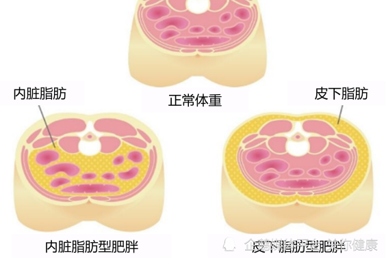 为健康而减肥，需要关注内脏脂肪指数，抓住5个要点