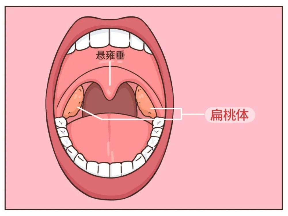 最想割掉的身体部位（不是阑尾）