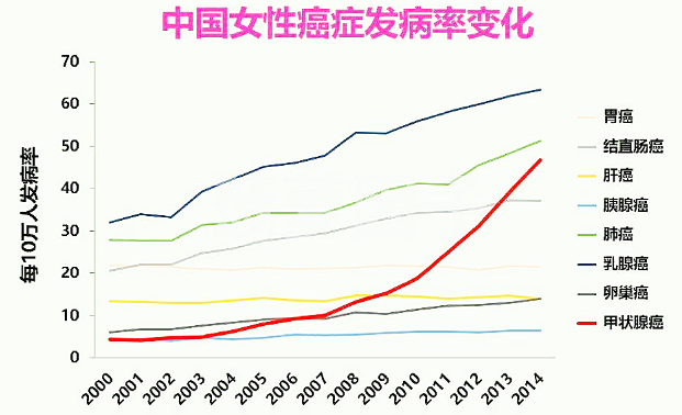 一家三口患上甲状腺癌，出现6个信号别大意了