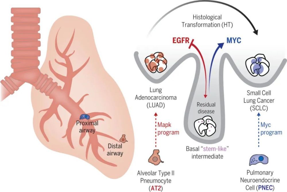 《科学》：肺腺癌向小细胞肺癌转化的关键分子事件，终于找到了！