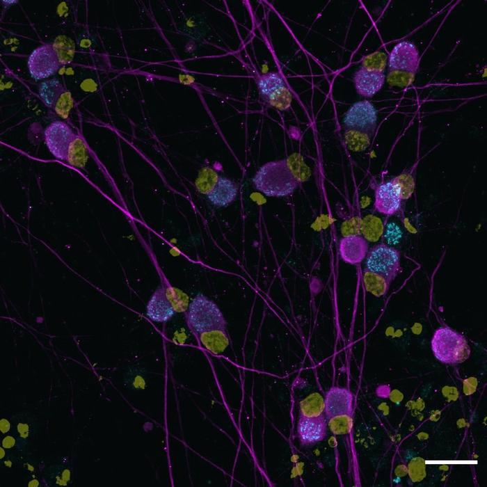 刚刚咬你的蛇有没有毒？一张试纸就能检测出来 | 环球科学要闻