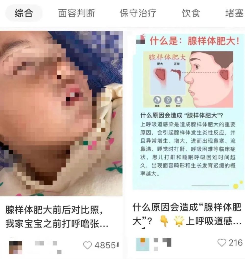 为什么现在患腺样体肥大的孩子越来越多?