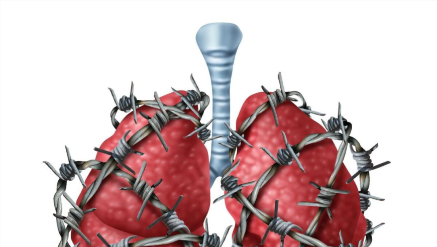 肺部四大慢性病，每一种都很难除根，常年咳嗽咳痰最终呼吸困难