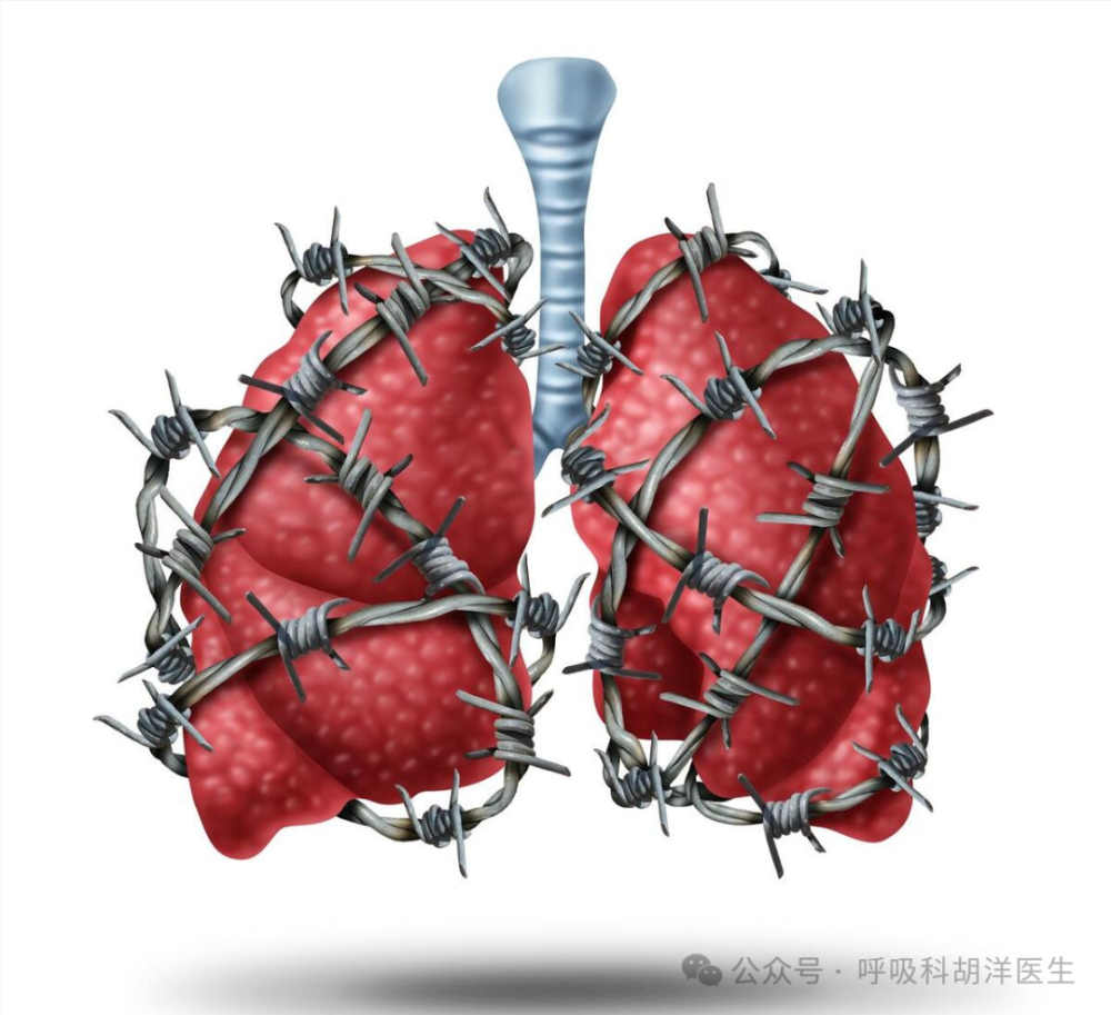 肺部四大慢性病，每一种都很难除根，常年咳嗽咳痰最终呼吸困难