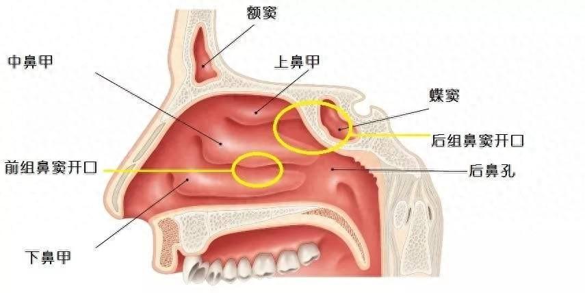 鼻窦癌怎么回事？怎样潜伏起来的？如何早期预防？五大误解不要犯