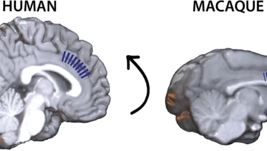 猕猴与人脑功能连接有何差异？追踪探索新知识！