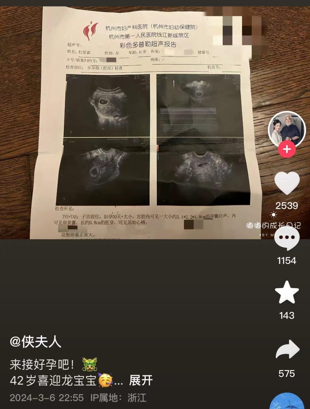 张纪中小31岁妻子官宣怀龙宝宝，晒彩超照感谢上天馈赠，回应老公“宝刀未老”言论