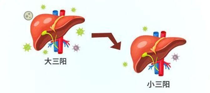 乙肝患者抗病毒五年后的3个好消息与2个坏消息