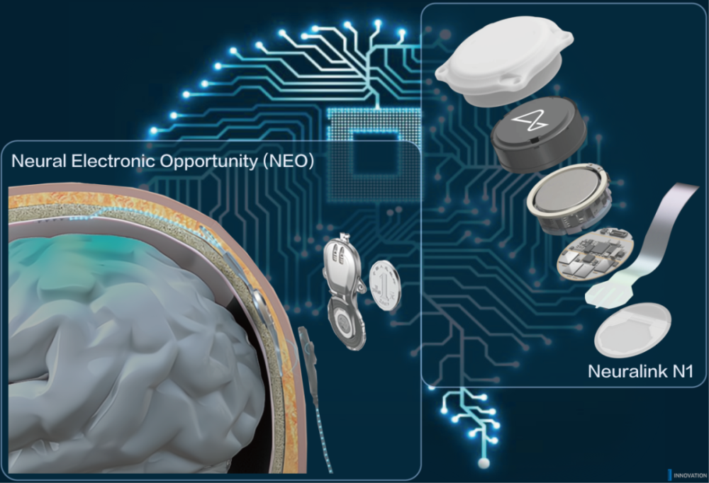 The Innovation | 全植入式无线脑机接口人体试验：持续向未来迈进