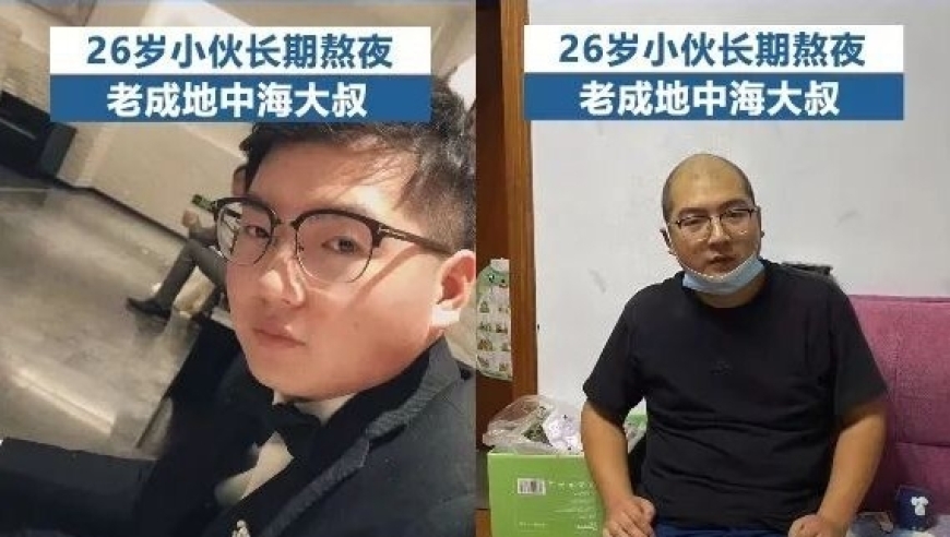 男生瞬间变老成大叔！6个让你快老的习惯，赶快改！