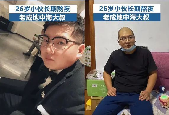 男生“断崖式衰老”变大叔！加速衰老的6个生活习惯，一定要改！