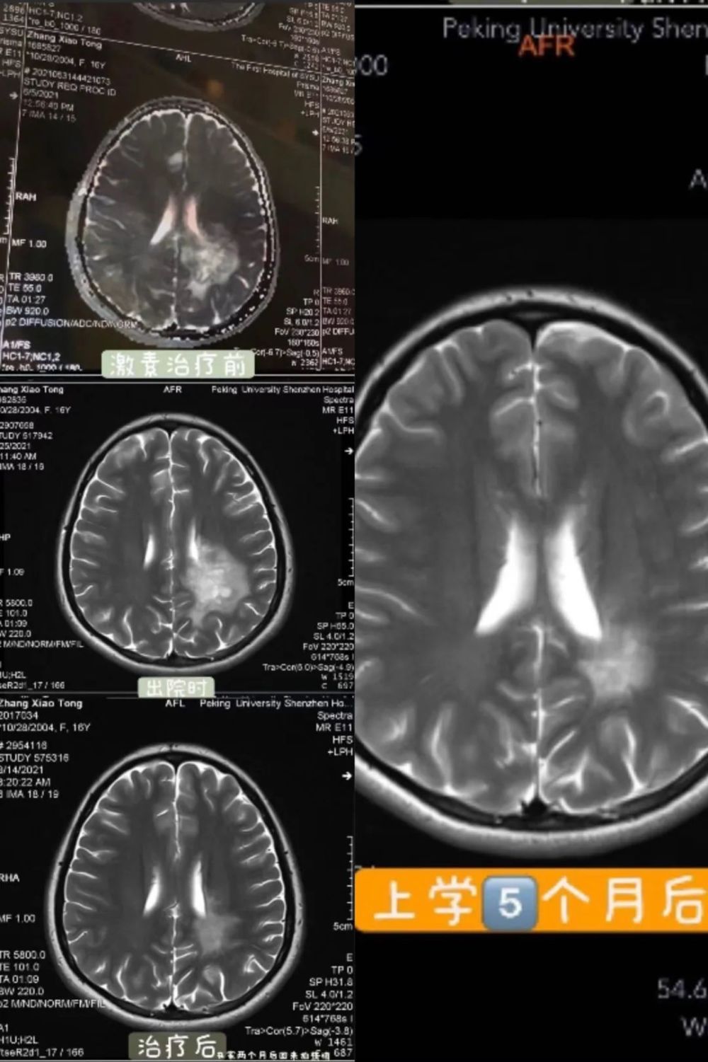 脆皮综合症：小病小痛不断的年轻人