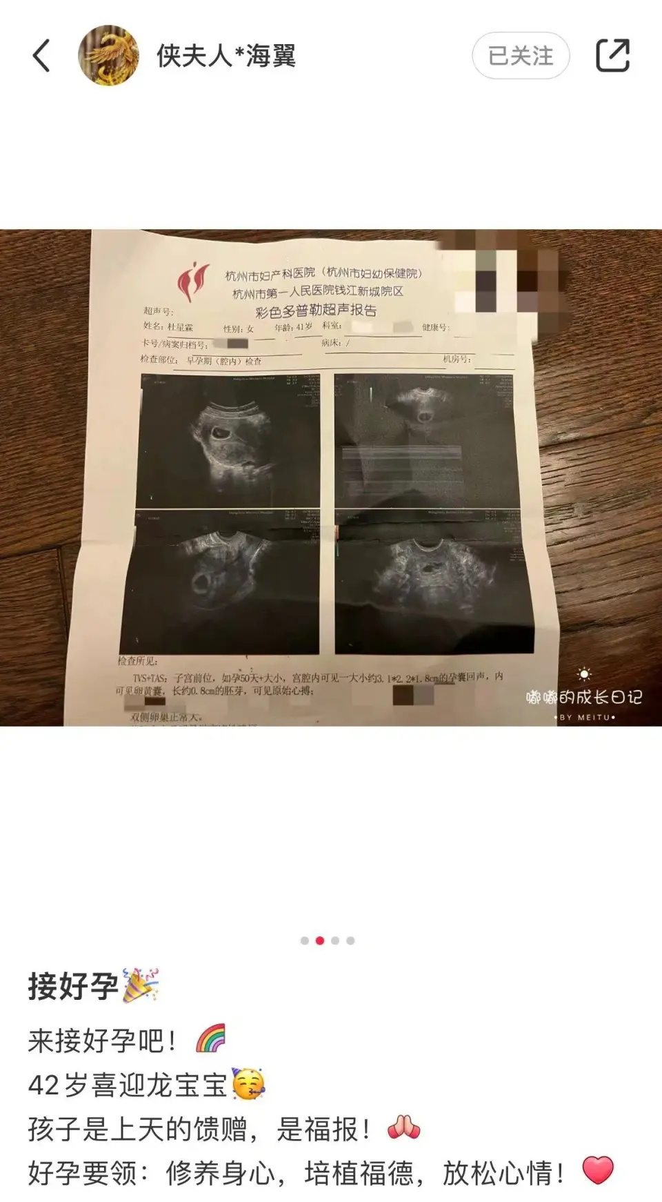 张纪中和妻子回应三胎！称72岁男人生孩子很正常，曾表示精力很充沛