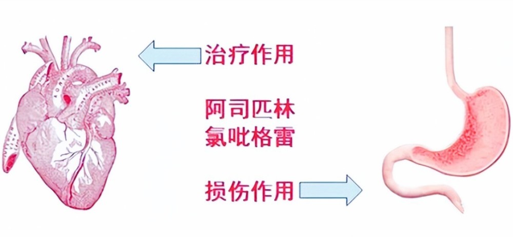 8旬老人冠脉支架5年莫名鼻出血，原来“双联抗血小板”忘了减药