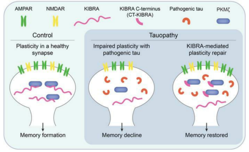 JCI：科学家发现，不改变tau病理，也可修复突触可塑性，改善痴呆相关记忆缺陷