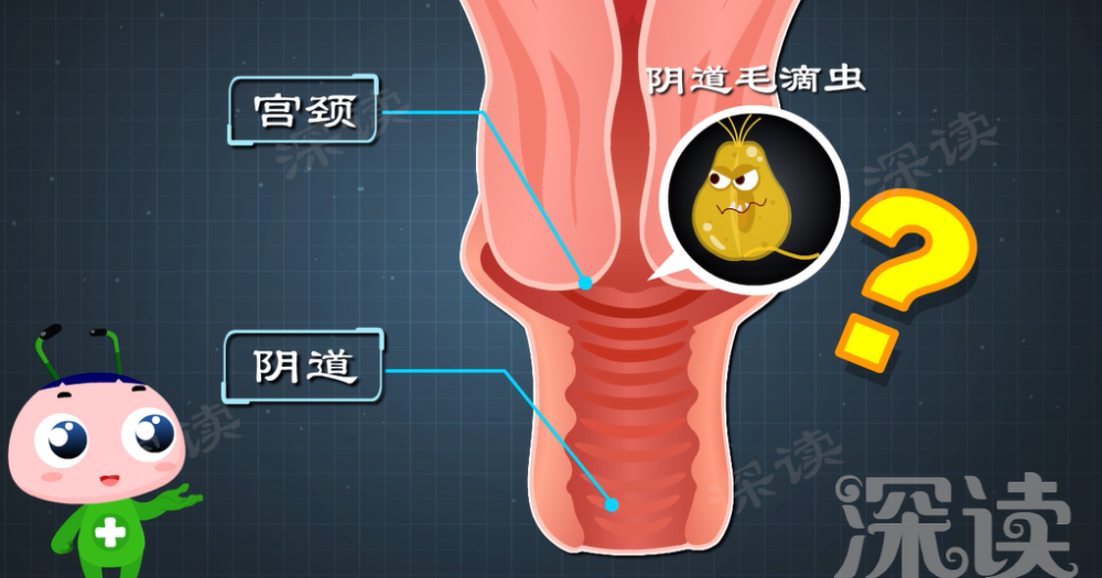 宫颈炎是因私生活乱？洗洗真的更健康？躲开宫颈炎就得做好这4点