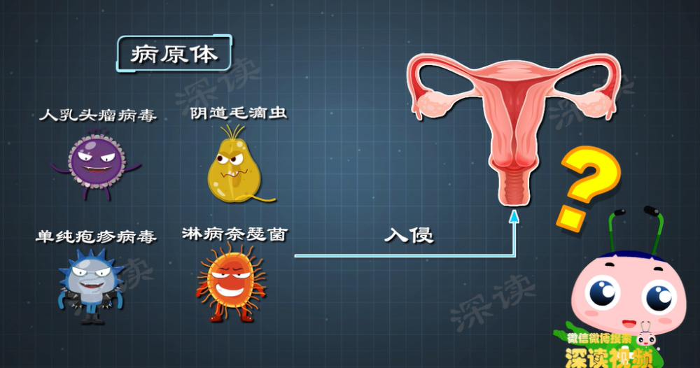 宫颈炎是因私生活乱？洗洗真的更健康？躲开宫颈炎就得做好这4点