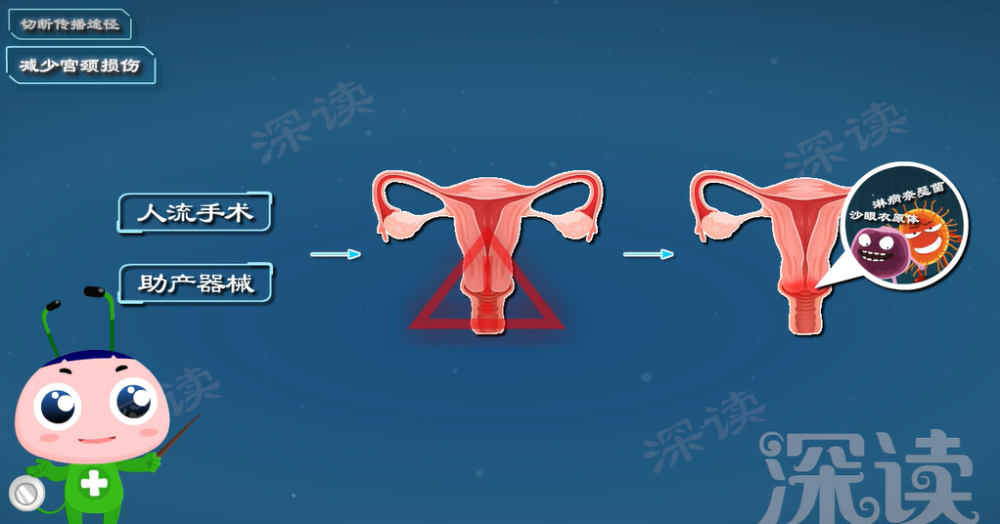 宫颈炎是因私生活乱？洗洗真的更健康？躲开宫颈炎就得做好这4点