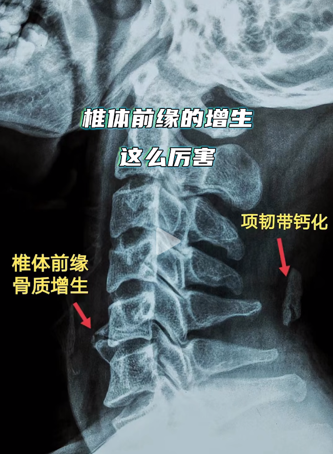 体内有疾，手指先知？提醒：经常手麻，可能是5种大病征兆