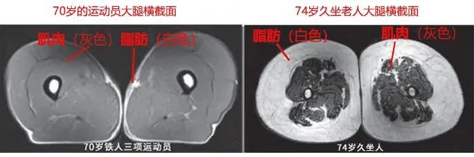 坚持锻炼相当于一年多赚17万元？坚持运动和从不运动的人，差别有多大？