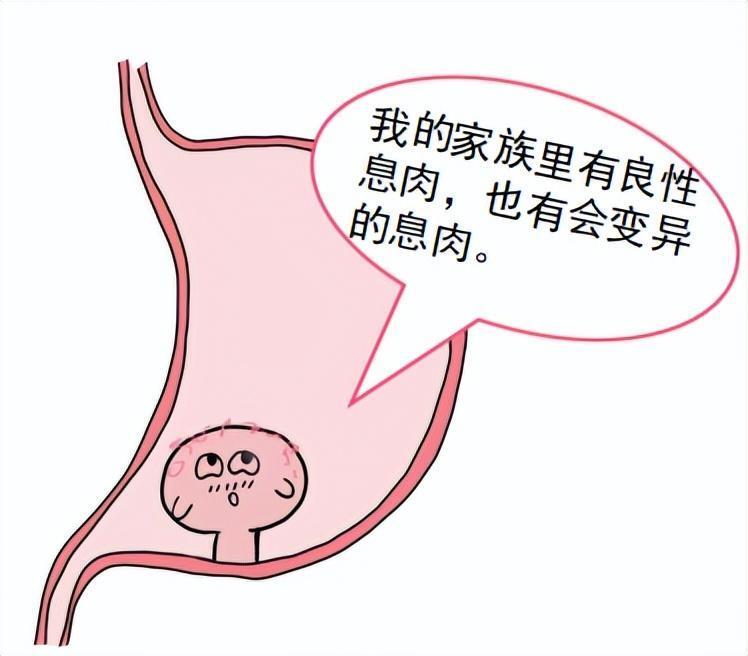 胃肠息肉与胃肠溃疡：守护你的“胃”来“肠”往