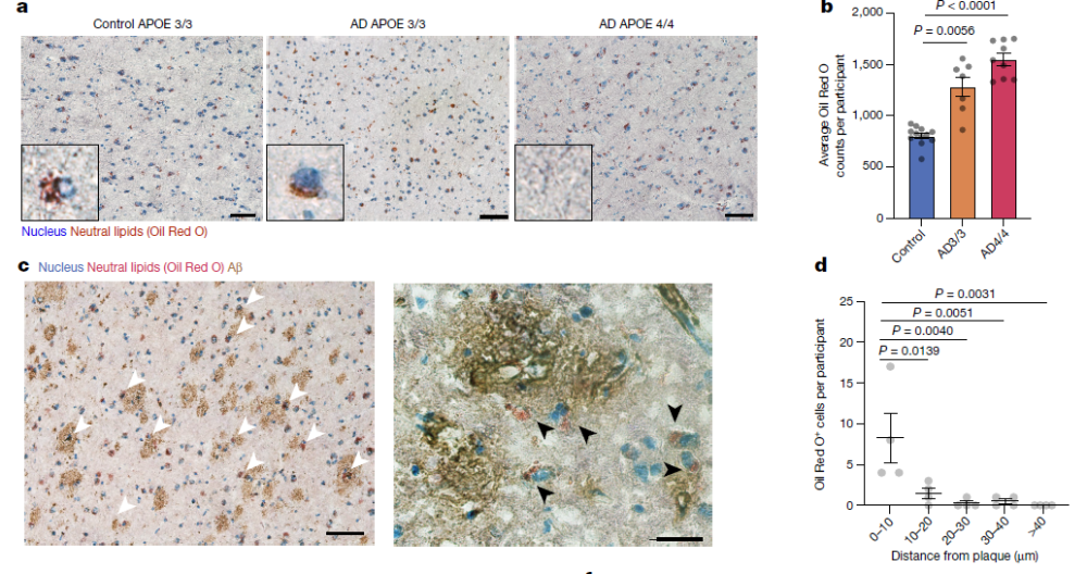 《自然》重磅：被忽略百年的发现终获证实！阿尔茨海默病的隐藏“元凶”找到了