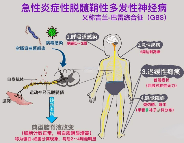 孩子四肢无力、行走困难，到底是怎么一回事？