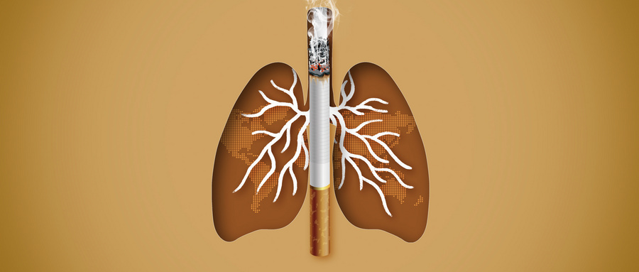 肺部实性结节多长时间复查CT？