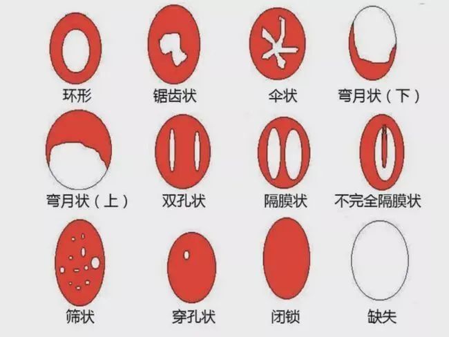 私密整形手术，她们偷偷地做