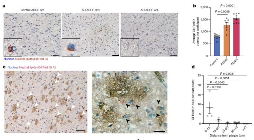 Nature | 被忽略百年的发现终获证实！阿尔茨海默病的隐藏“元凶”找到了