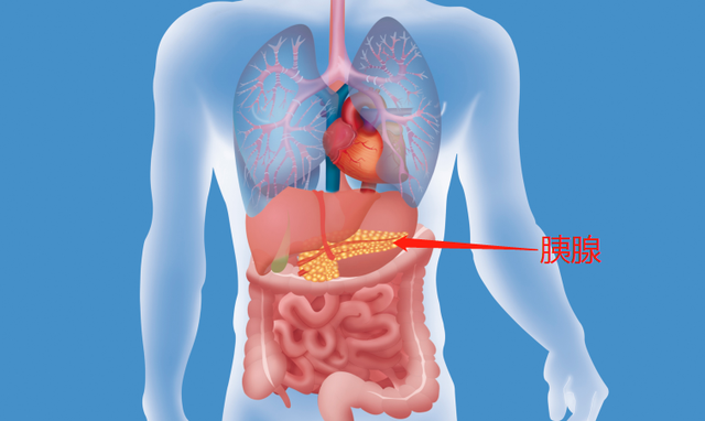 人体胰腺到底在哪？胰腺癌怎么回事？深入解读，全面防治