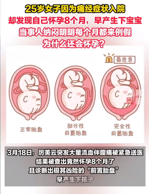 "传奇孕妇8个月未察觉痛经孕育双胞胎：谜团终于解开：她曾历经生死考验，却意外怀下两个健康男婴！"