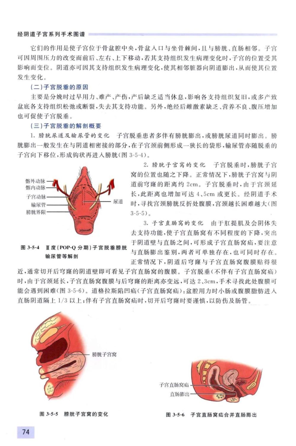 "全面解析：经阴子宫全切除与阴道前后壁修补术的视觉展示及操作流程详解——图解剖析（详解版）"