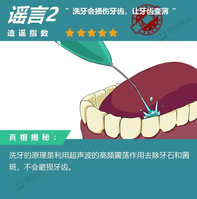 "清口守护者：揭秘洗牙十大真实传言，看99%中国人都相信的事实！"